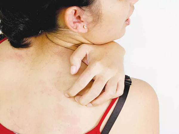 Trời hanh khô cộng thêm ô nhiễm, cách đơn giản cắt cơn ngứa da mùa đông