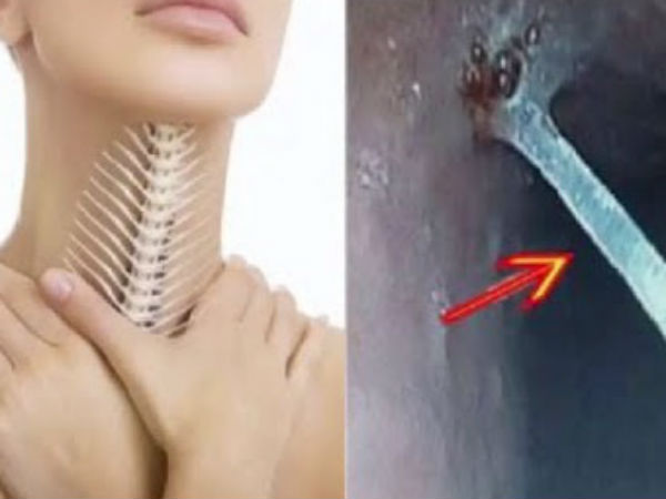 Hóc xương cá đừng có dại mà dùng thứ này chữa kẻo thiệt thân, hãy dắt túi ngay từng bước sơ cứu dưới đây!