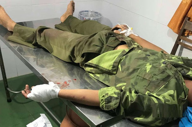 Đắk Lắk: Lâm tặc vây chém đứt gân tay kiểm lâm để giải cứu đồng bọn