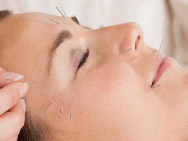 Bệnh dễ gặp mùa đông: Bỗng dưng ngủ dậy mặt bị biến dạng