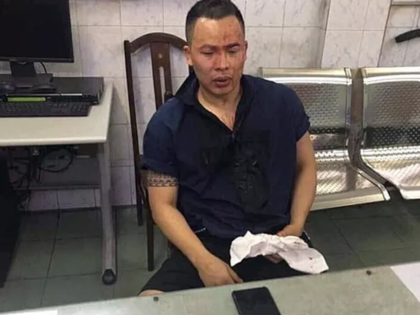 Vũ Khắc Tiệp và những phát ngôn gây sốc trước khi thừa nhận bị giang hồ 'xử'