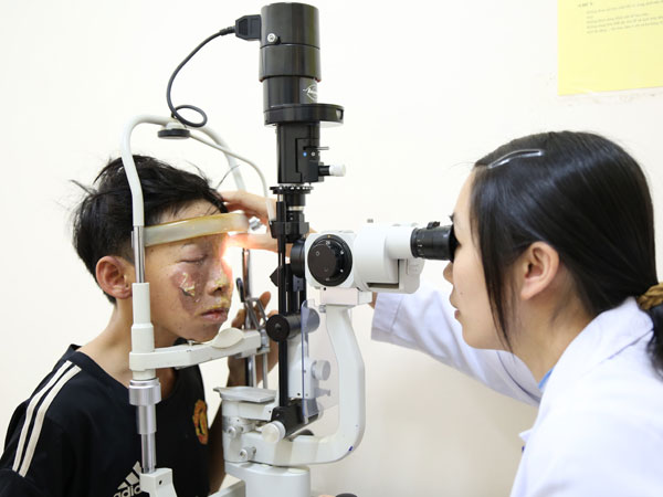 Chế tạo pháo chơi Tết, nam sinh Hà Tĩnh suýt mù mắt