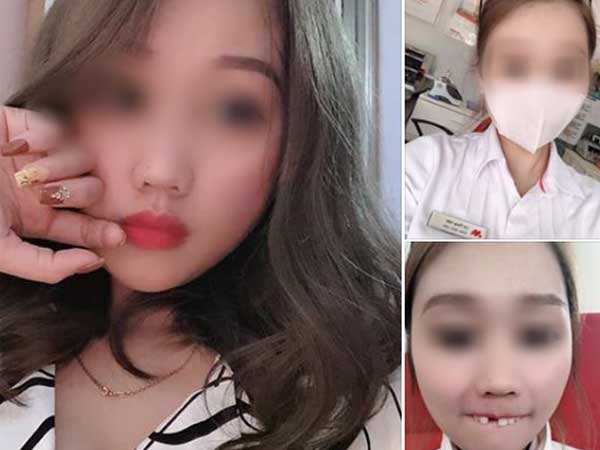 Cắn hướng dương ngày Tết, cô gái trẻ bị... rụng cả răng cửa tốn thêm bạc triệu để làm mới