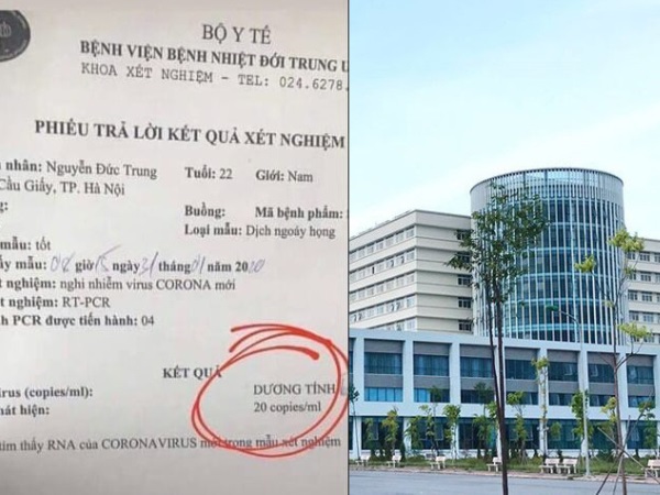 Xuất hiện kết quả xét nghiệm dương tính với nCoV giả mạo