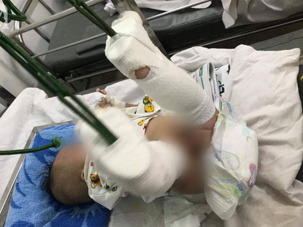Thực hư chuyện cha ruột ngáo đá bạo hành dã man con trai 4 tháng tuổi ở TP.HCM