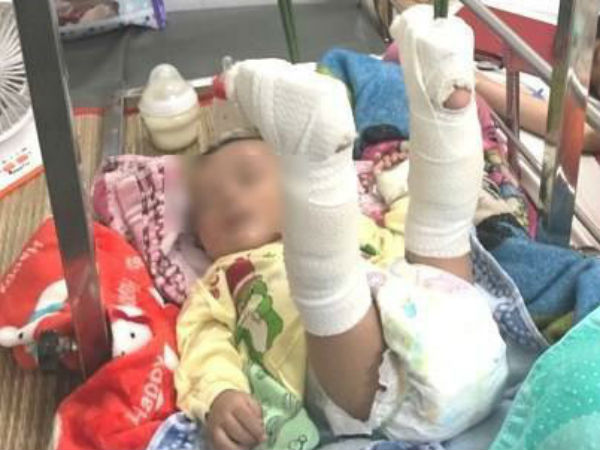 Làm giấy khai sinh cho bé 4 tháng bị bố đánh gãy chân: Mang họ mẹ, tên cha để trống
