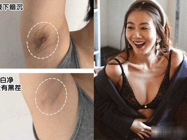 10 loại kem tẩy lông vừa dịu nhẹ lại hiệu quả cao trong việc dọn sạch đám 'rừng rậm'