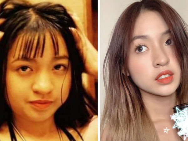 'Crush của mọi chàng trai' gây bất ngờ khi công khai ảnh quá khứ nặng 65kg, chưa niềng răng xong
