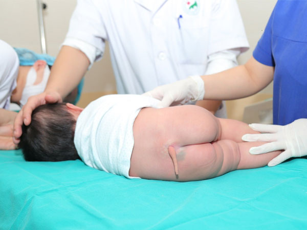Kỳ lạ bé gái 5 tháng tuối ở Hà Nội có chiếc đuôi dài gần 10cm