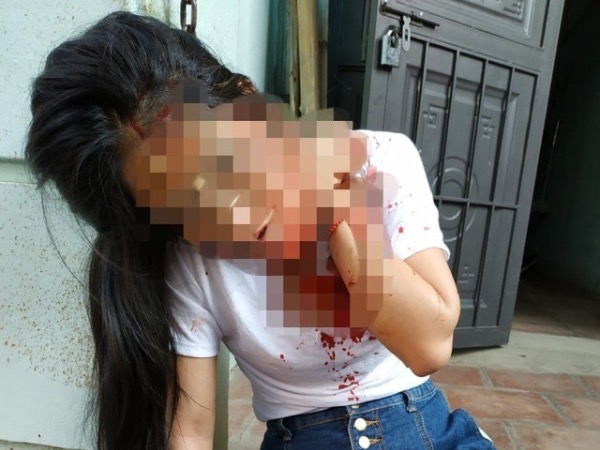 Cụ ông 74 tuổi đâm trọng thương con gái riêng của vợ 'hờ'