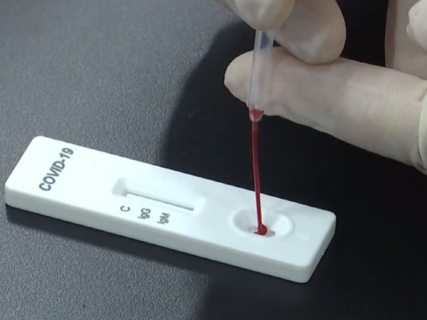 Mỗi ngày Việt Nam có thể xét nghiệm tìm Covid-19 từ 8.000 - 10.000 mẫu
