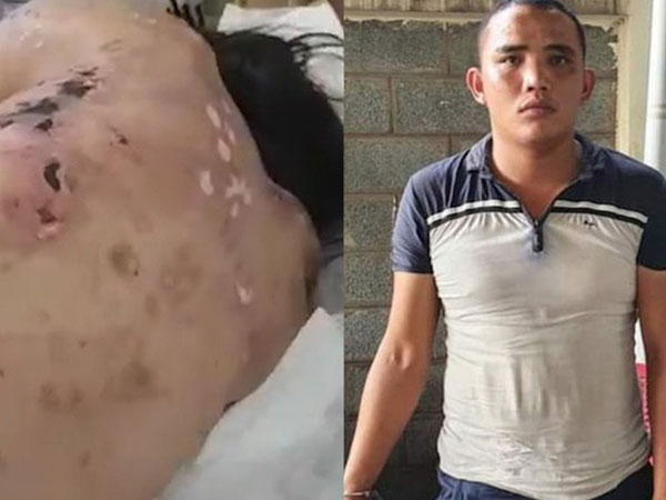Chuỗi ngày kinh hoàng trong quán cà phê kích dục của nữ tiếp viên bị đánh thương tật 96%