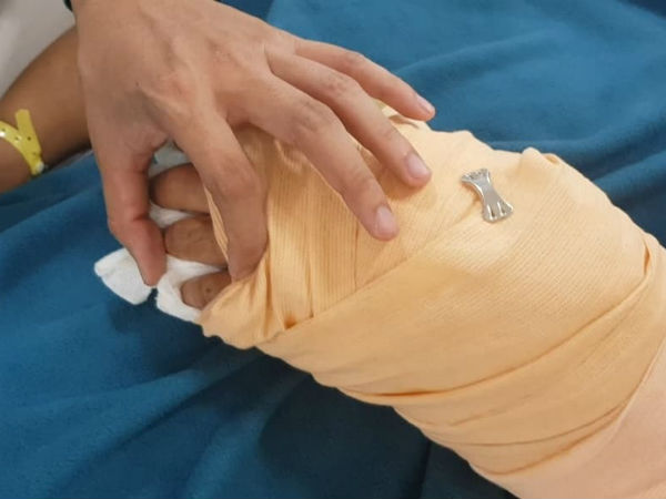 Nạn nhân bị chém lìa tay kể lại giây phút bị truy sát trên phố Sài Gòn
