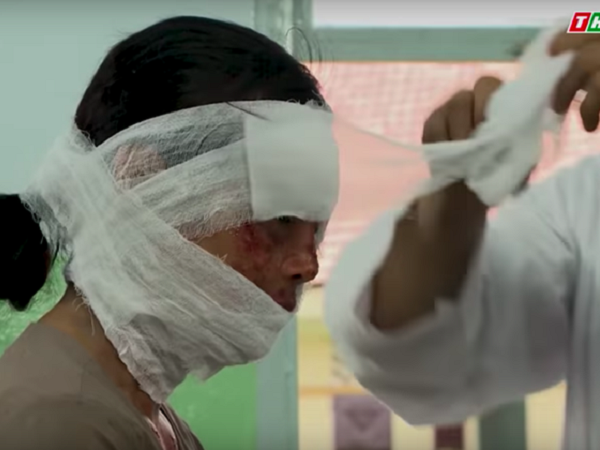 Luật trời tập 11: Mẹ nuôi Bích bị phá hủy gương mặt vì cứu con khi cháy nhà