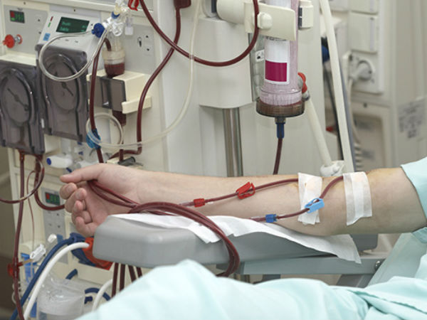 10 điều bệnh nhân chạy thận nhân tạo cần biết trong đại dịch COVID-19