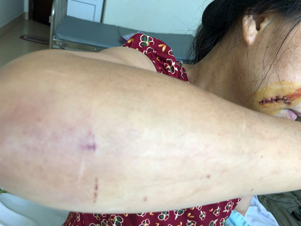 'Phi công trẻ' dùng mã tấu chém gục người tình rồi kéo ra giữa sân lột đồ