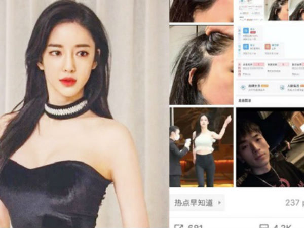 Nữ idol được mệnh danh là 'bản sao 19 tỷ của Angela Baby' tung loạt ảnh gây sốc tố cáo bị CEO đánh đến mức mặt biến dạng