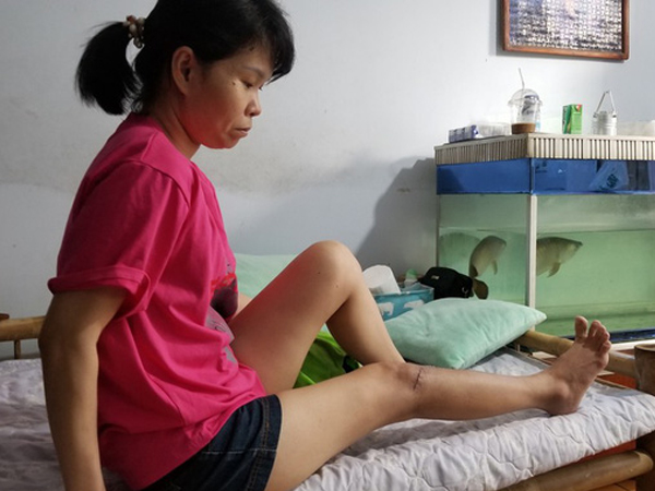 Nữ kế toán bị cháu của giám đốc siêu thị đánh gãy chân