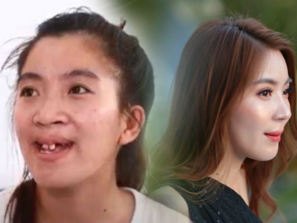 Cô gái hàm ếch bị trêu là đứa không môi 'lột xác' xinh đẹp và giọt nước mắt của người cha tần tảo khiến nhiều người xúc động