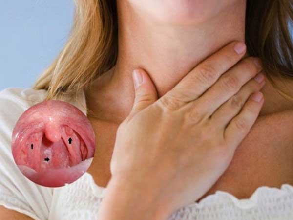 3 chị em bị ung thư vòm họng, bác sĩ cảnh báo thực phẩm nhiều người thích