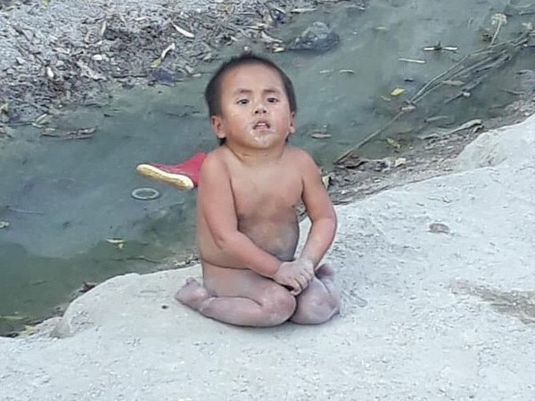 Hình ảnh mới nhất của em bé Mường Lát liệt hai chân co ro giữa giá rét sau 3 năm được nhận nuôi