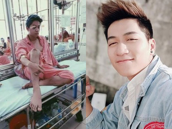 Ca sĩ Quán quân Giai điệu chung đôi bị chấn thương não, liệt nửa mặt vì tai nạn