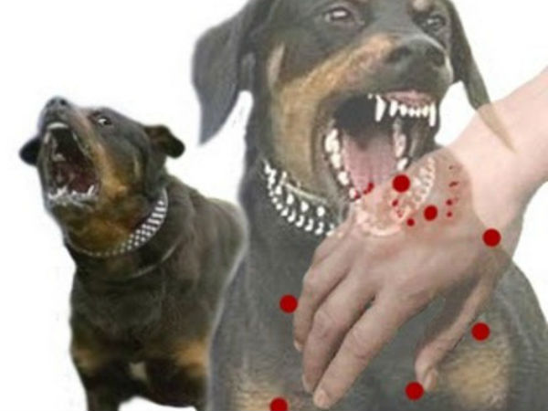 Nghệ An: Chó phát bệnh dại cắn liên tiếp 2 cháu nhỏ
