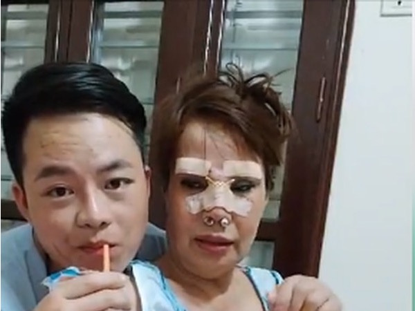 'Cô dâu 62 tuổi' chơi lớn chi 50 triệu đồng nâng mũi, sửa lông mày để tân trang nhan sắc
