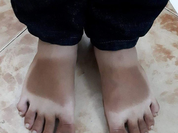 Bộ sưu tập 'áo da' rằn ri của hội hay ra đường mà không che chắn vào mùa nắng đỉnh điểm khiến ai cũng phải bất ngờ