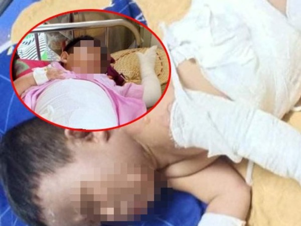 Bắt 5 đối tượng phóng hoả khiến 2 trẻ bỏng nặng