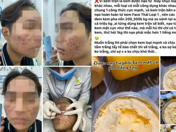 Sự thật đáng sợ trong 'thế giới kem trộn': Kinh hãi và ám ảnh!