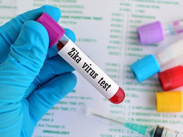 Phát hiện 32 người nhiễm virus Zika