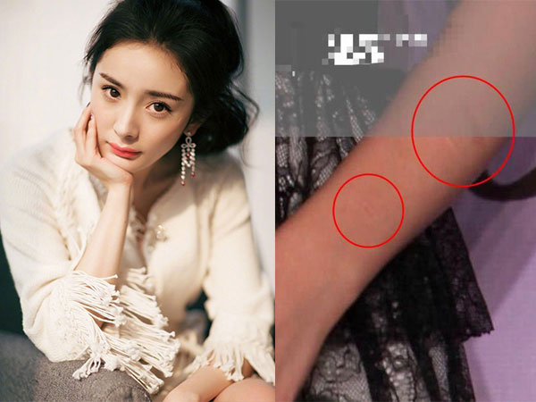 Loạt ảnh thời quá khứ bất ngờ bị 'đào mộ', Dương Mịch khiến fan lo lắng khi để lộ sẹo làm dấy lên nghi vấn ngược đãi bản thân bằng cách rạch cổ tay