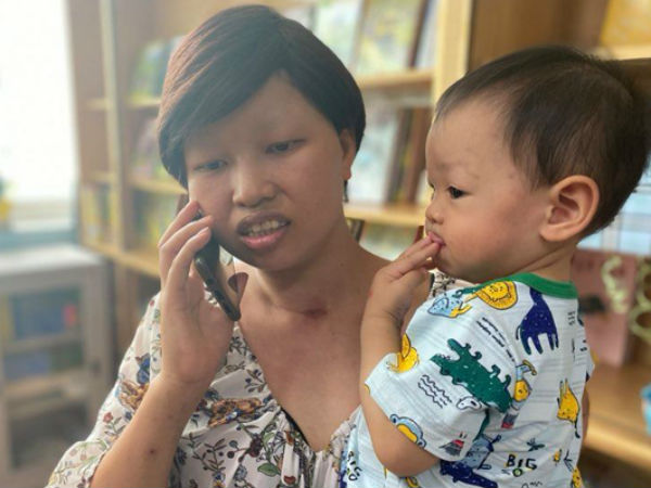 Mẹ con Bình An sau 1 năm thực hiện ca mổ ngồi bắt thai