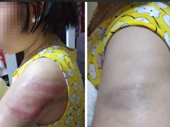 Đình chỉ giáo viên dùng thước đánh học sinh ở Nam Định