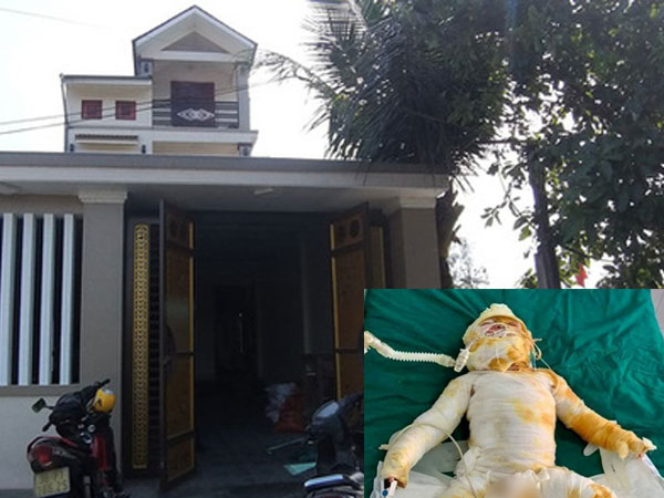 Vụ hỏa hoạn khiến 4 người bỏng nặng khi đang ngủ: Bố và con nhỏ 9 tháng đã tử vong