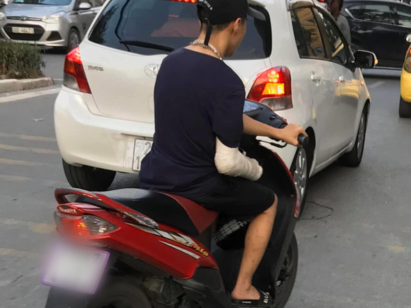 Xôn xao hình ảnh nam thanh niên bị gãy tay phải, vẫn liều mình vặn ga xe máy bằng... tay trái