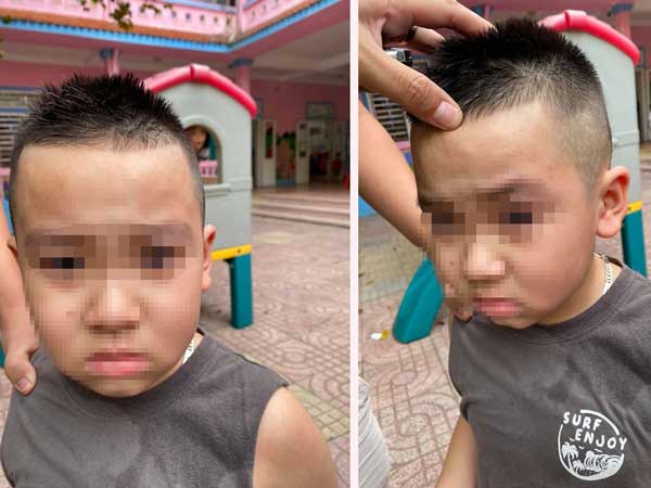 Thấy con đi mẫu giáo bị bạn cấu xước mí mắt, phụ huynh đến tận trường tát thẳng mặt trẻ trước mặt cô giáo khiến dân tình phẫn nộ