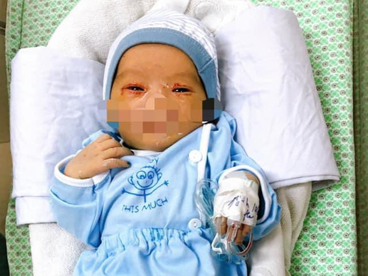 Bé sơ sinh bị bỏ rơi hơn 40 giờ nghi bị nhiễm trùng máu, bác sĩ dồn lực cứu chữa