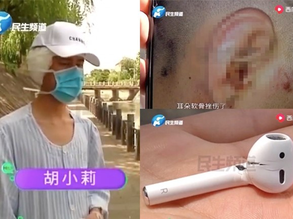Ngất xỉu vì AirPods phát nổ trên tai