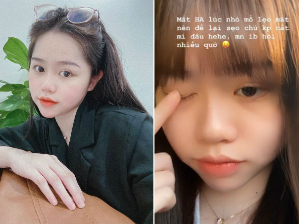 Nói chung là vẫn chưa hết bị soi, bạn gái Quang Hải vừa lý giải vì sao có đôi mắt trông như cắt mí