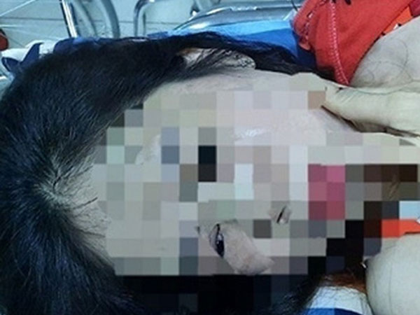 Điều tra người phụ nữ nghi bị chồng hờ bạo hành dã man
