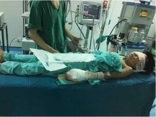 Thiếu niên bị nát tay, vỡ nhãn cầu cả 2 mắt sau tiếng nổ lớn