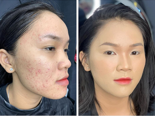 Cô nàng chia sẻ bí quyết đánh nền che mụn rỗ hiệu quả, 'đánh lừa thị giác' người nhìn