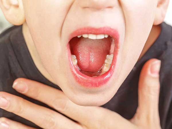 Liên tiếp xuất hiện các ổ bệnh bạch hầu: Các dấu hiệu nhận biết bệnh bạch hầu tuyệt đối không được bỏ qua