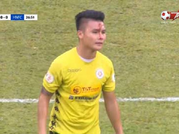 VIDEO: Quang Hải đổ máu sau pha va chạm nảy lửa với Tiến Linh