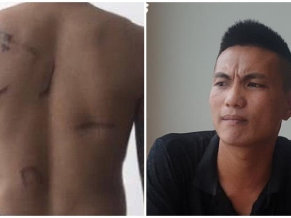 Khởi tố vụ án đàn em Đường 'Nhuệ' chém nam thanh niên sau 8 năm 'chìm xuồng'