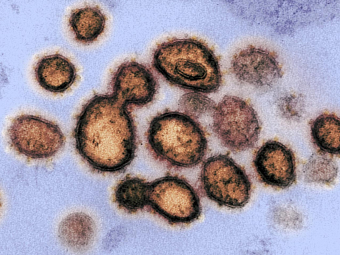 Nghiên cứu gây sốc: Phát hiện dấu vết virus SARS-CoV-2 từ tháng 03/2019