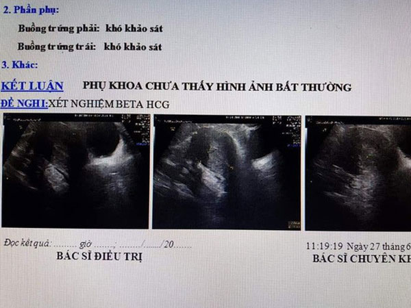 Vụ vác bụng đi đẻ ... nhưng không có thai: Siêu âm không có thai nhưng 'con' vẫn đạp trong bụng?