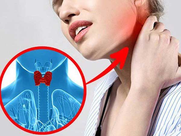 Ung thư tuyến giáp ngày càng trẻ hoá: Thấy 6 điểm bất thường này xung quanh vùng cổ thì bạn nên đi khám ngay